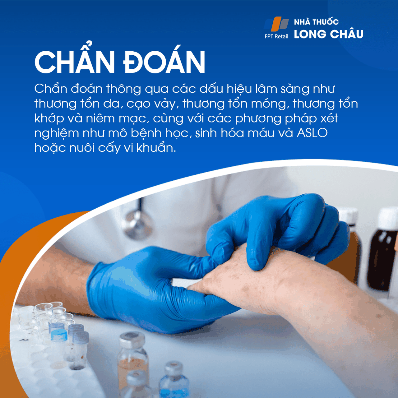 Chẩn đoán dựa trên tổn thương da, móng, khớp và các xét nghiệm như mô bệnh học, sinh hóa máu, ASLO