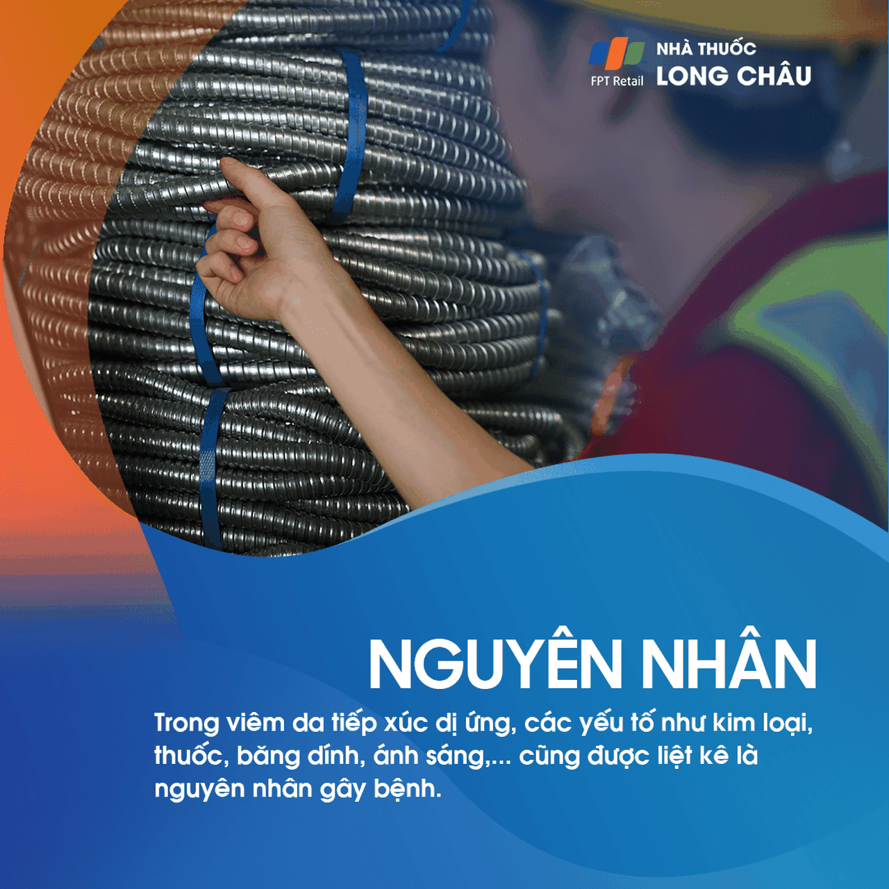 Viêm Da Dị Ứng 3