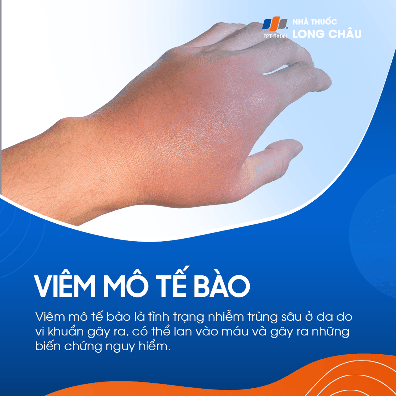 Viêm Mô Tế Bào 1