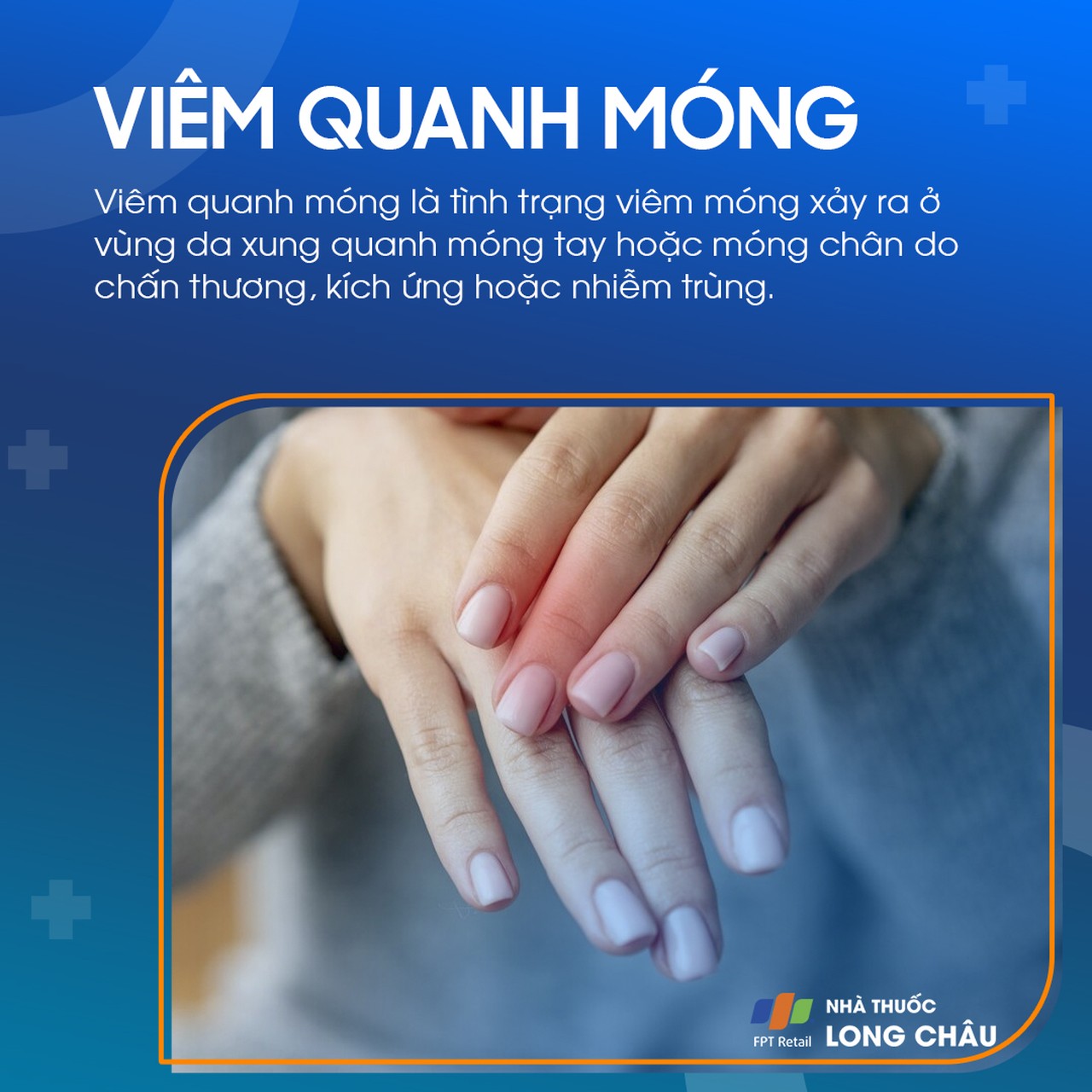 Viêm Quanh Móng 1