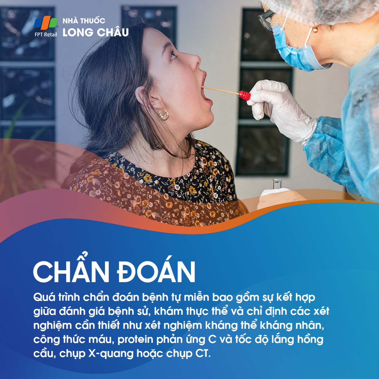 Chẩn đoán: Dựa trên khai thác bệnh sử, khám lâm sàng, xét nghiệm kháng thể, công thức máu, CRP, tốc độ lắng hồng cầu, X-quang hoặc CT