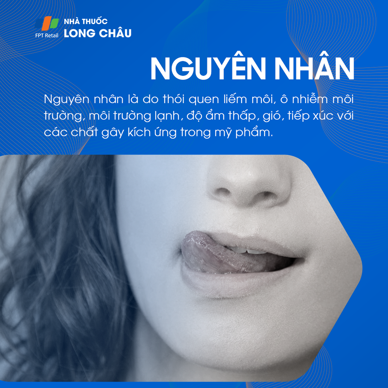 Nguyên nhân chàm môi do dị ứng và khô da