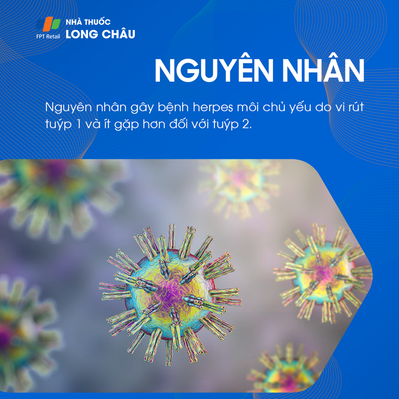 Nguyên nhân gây herpes môi như virus Herpes simplex và cách chẩn đoán