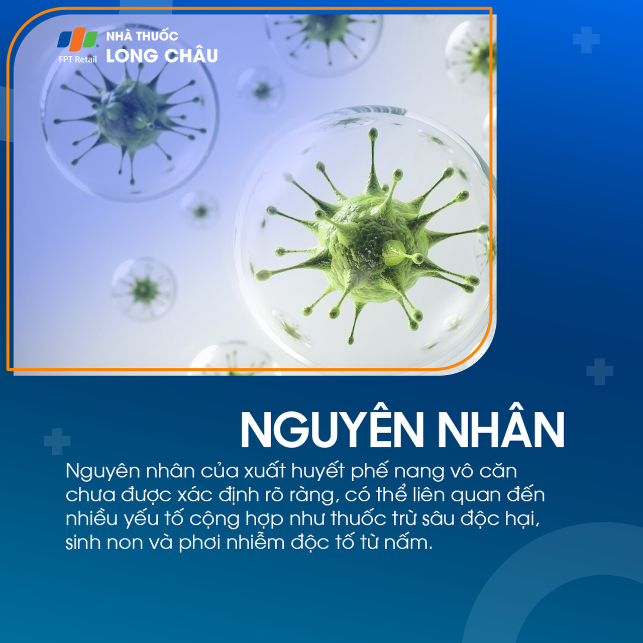 Xuất huyết phế nang vô căn 3