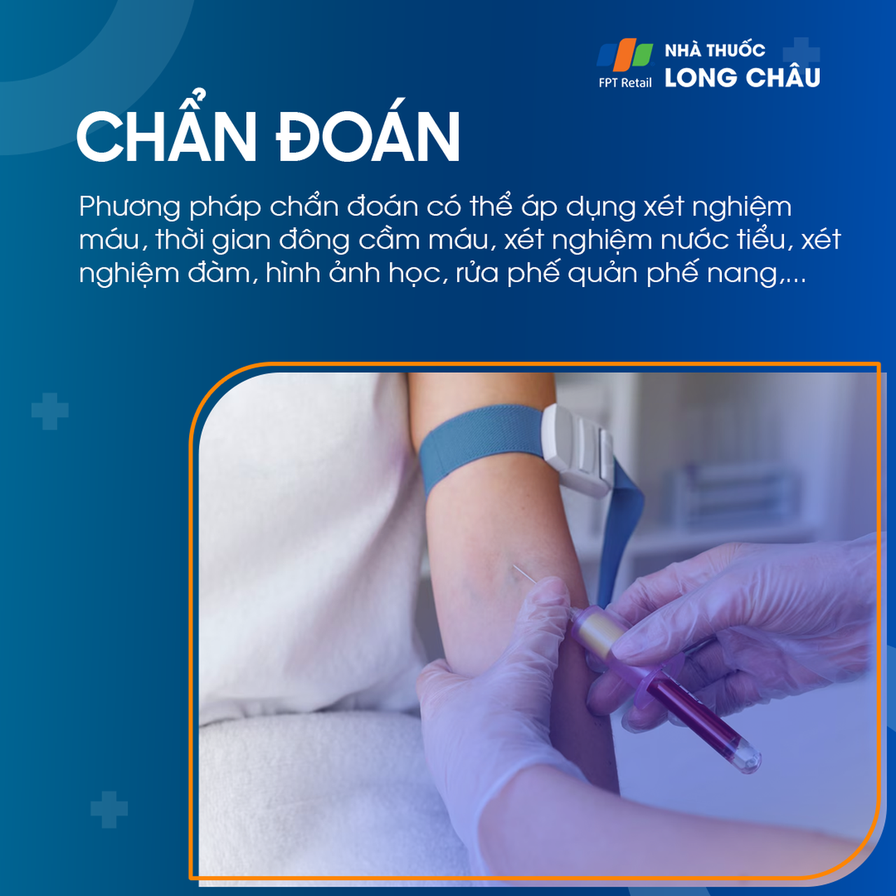 Xuất huyết phế nang vô căn 5