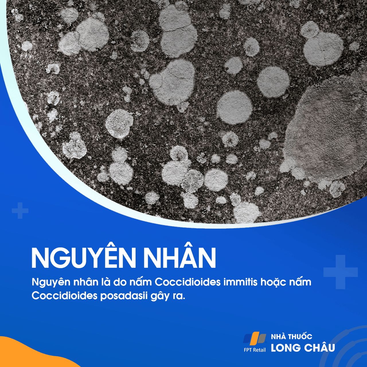 Bệnh nấm coccidioimycosis 4