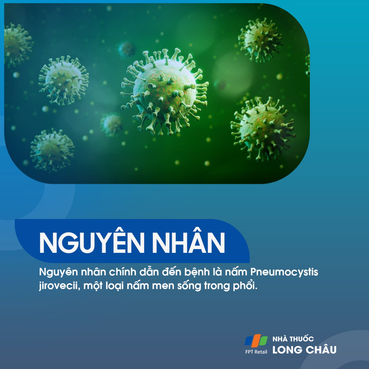 Viêm phổi Pneumocystis jirovecii 3