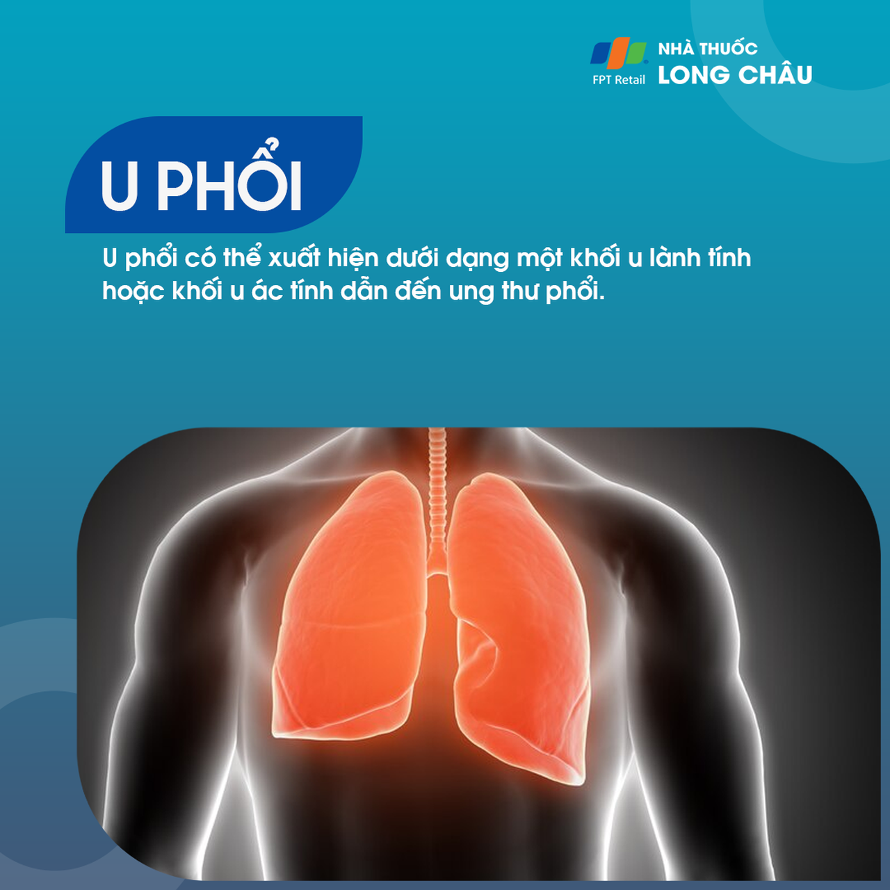 U phổi 1