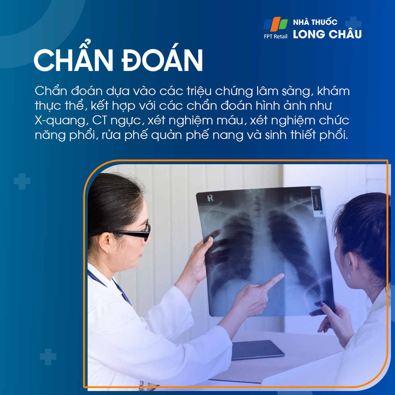 Viêm phổi kẽ lympho bào 5