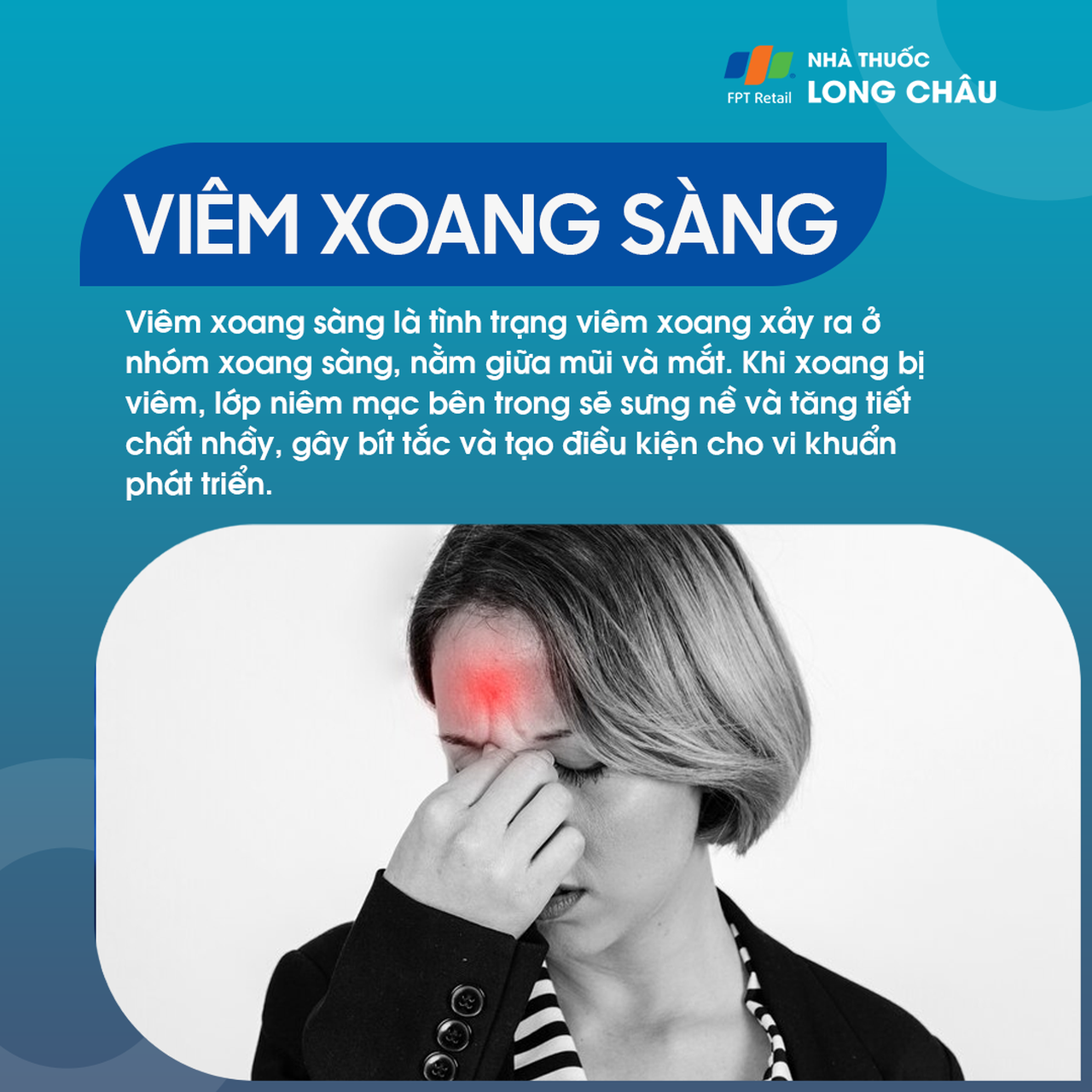 Viêm xoang sàng là tình trạng viêm của nhóm xoang sàng
