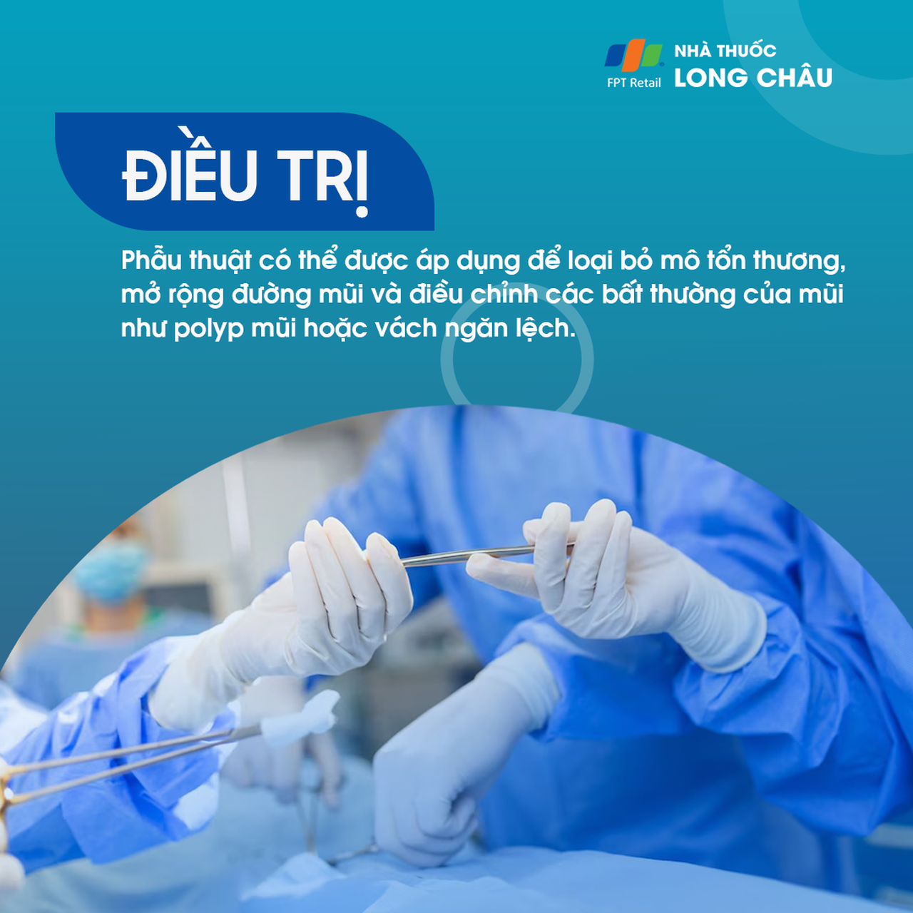 Phương pháp điều trị viêm xoang sàng