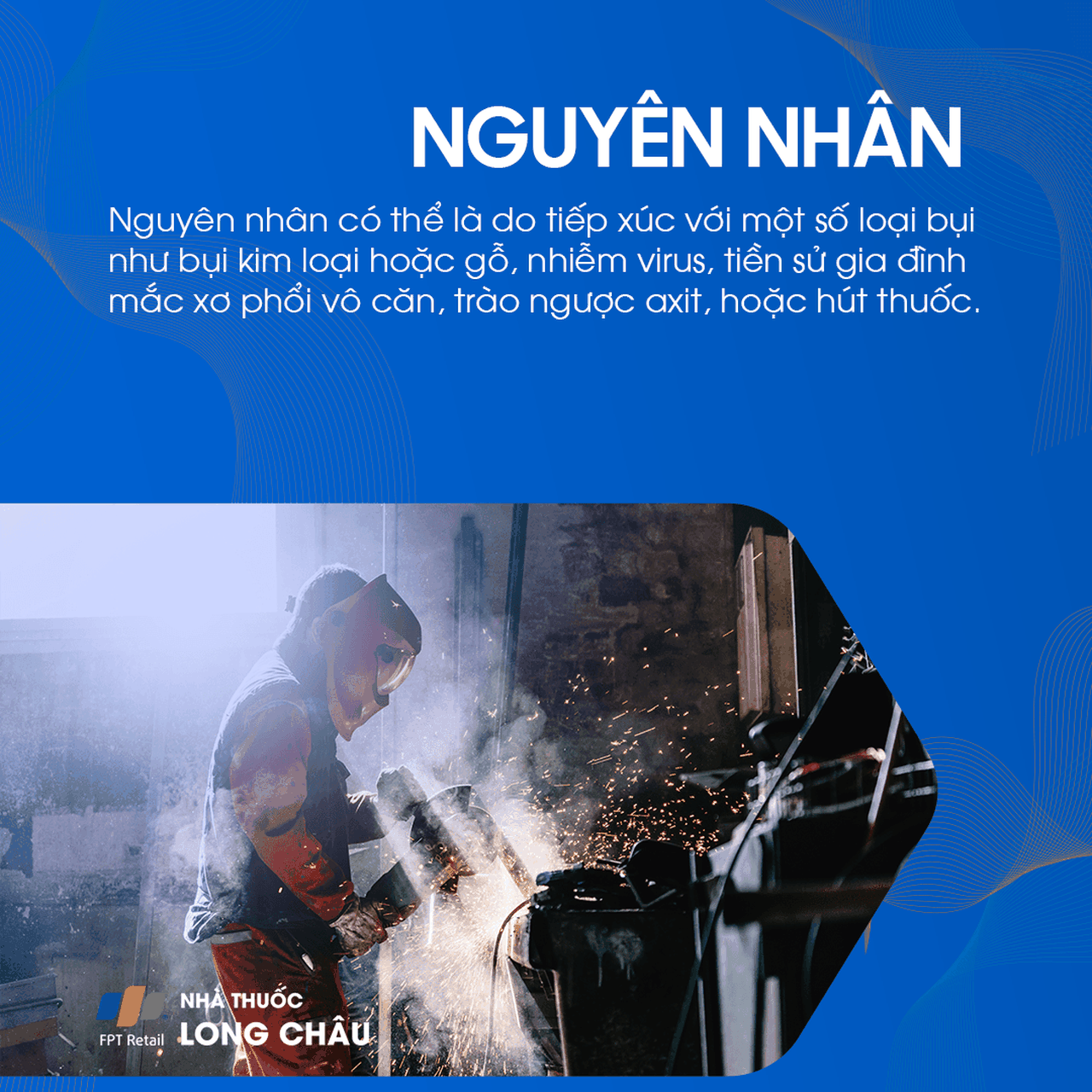 Xơ phổi vô căn 3