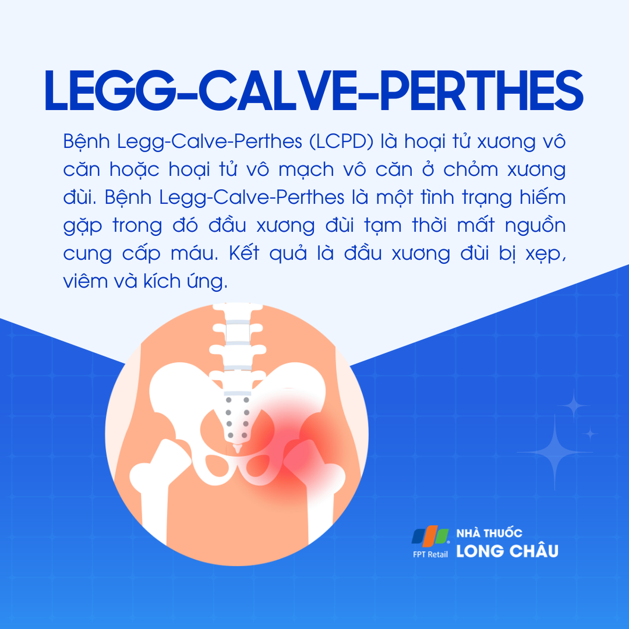 Bệnh Legg-Calve-Perthes 1