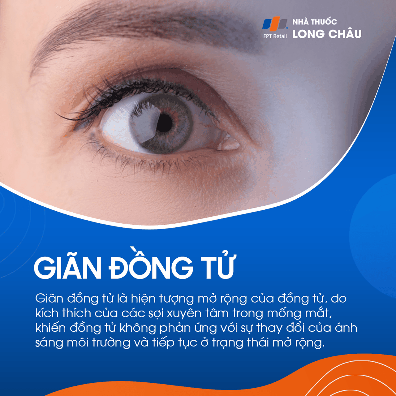 Giãn đồng tử 1