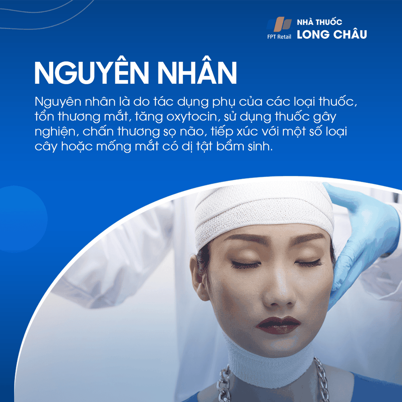 Giãn đồng tử 3