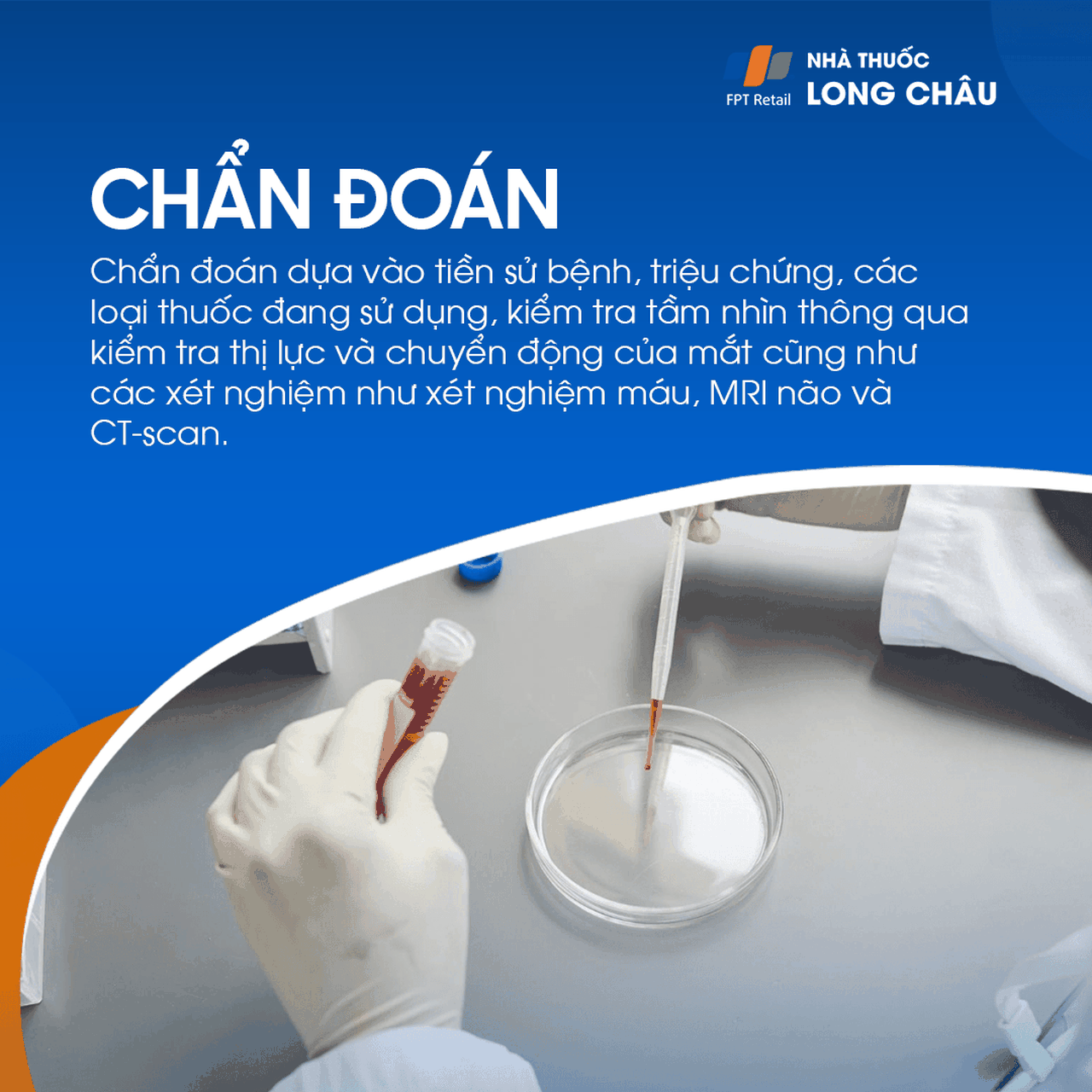 Giãn đồng tử 5