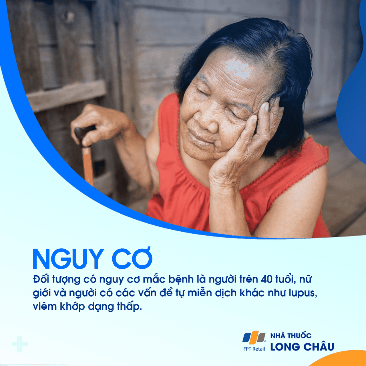 Hội chứng Sjogren 4