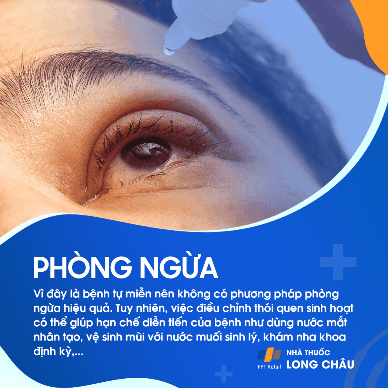 Hội chứng Sjogren 7