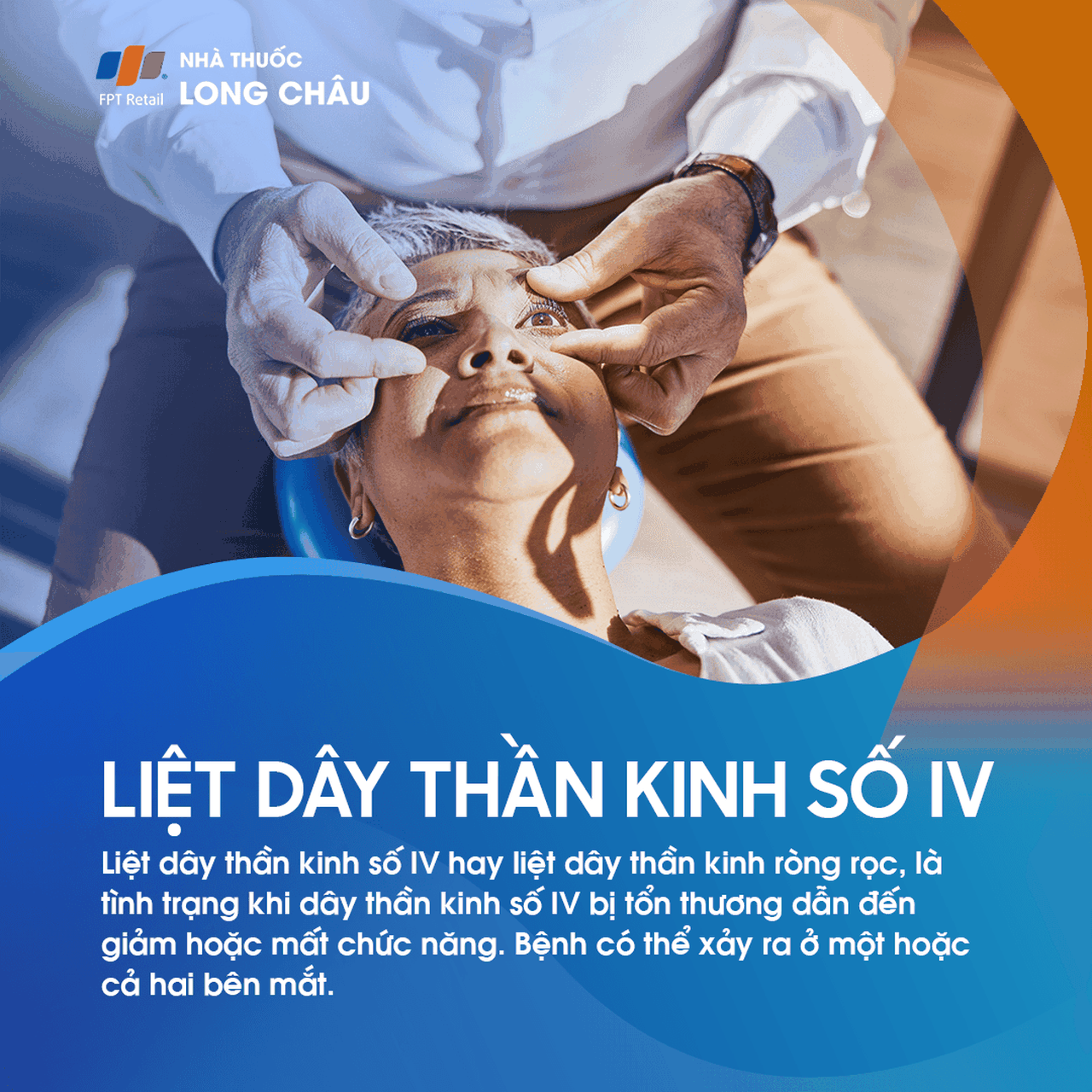 Liệt dây thần kinh số IV 1