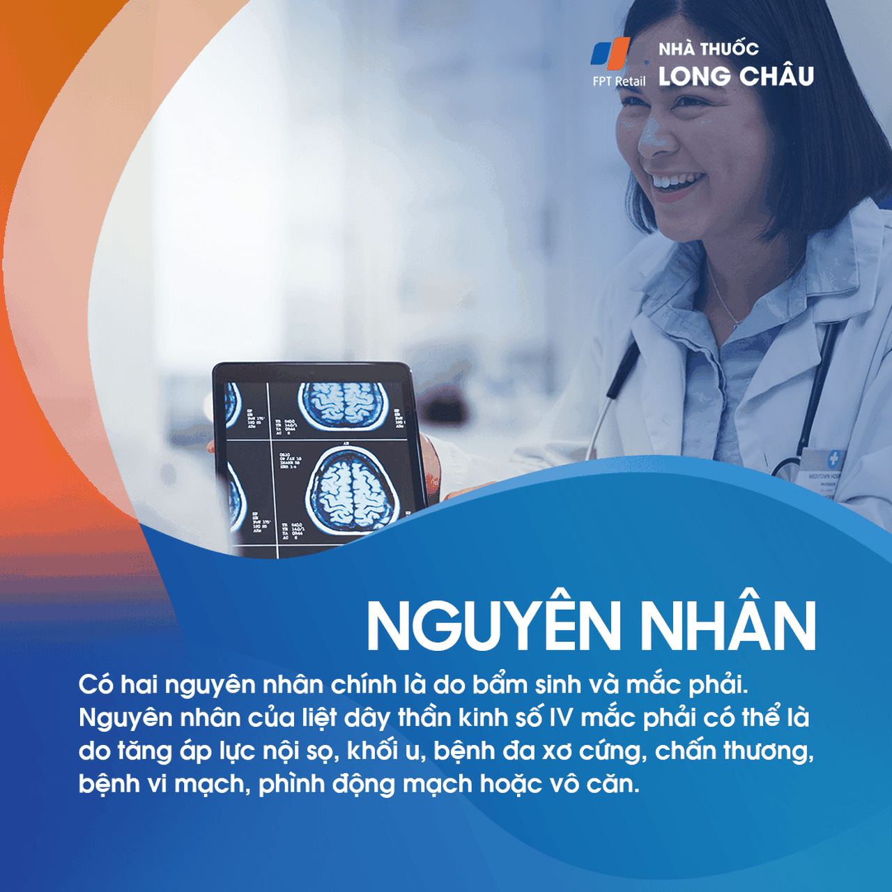 Liệt dây thần kinh số IV 3