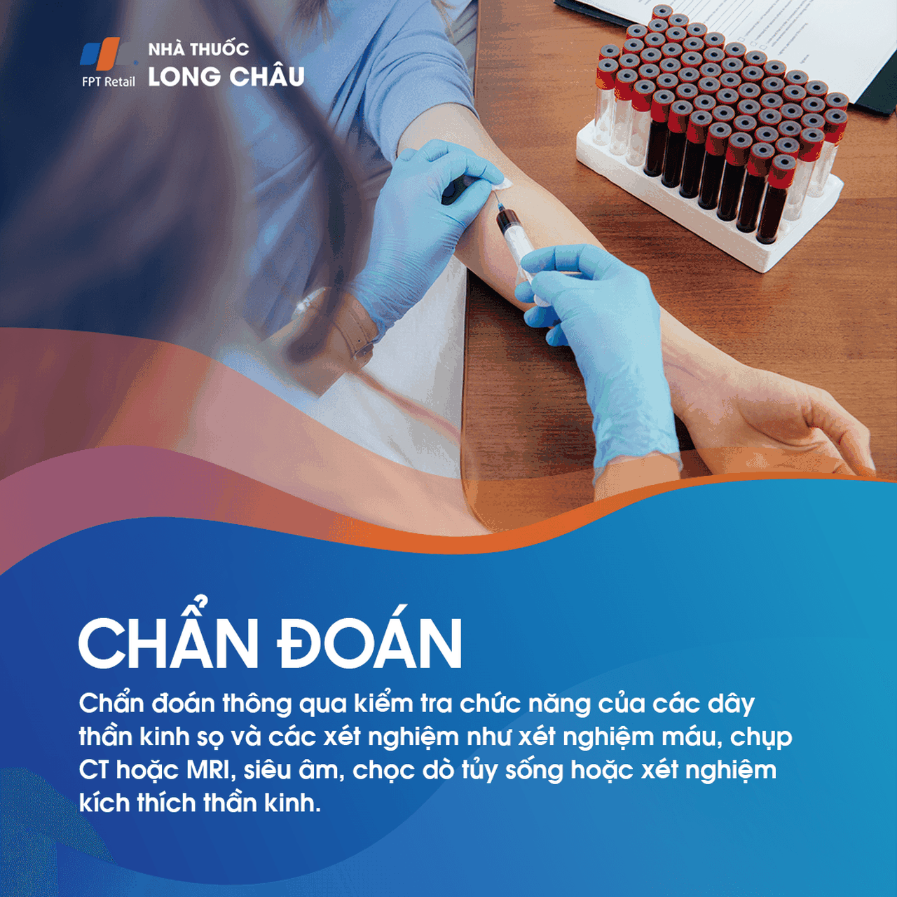 Liệt dây thần kinh số 5
