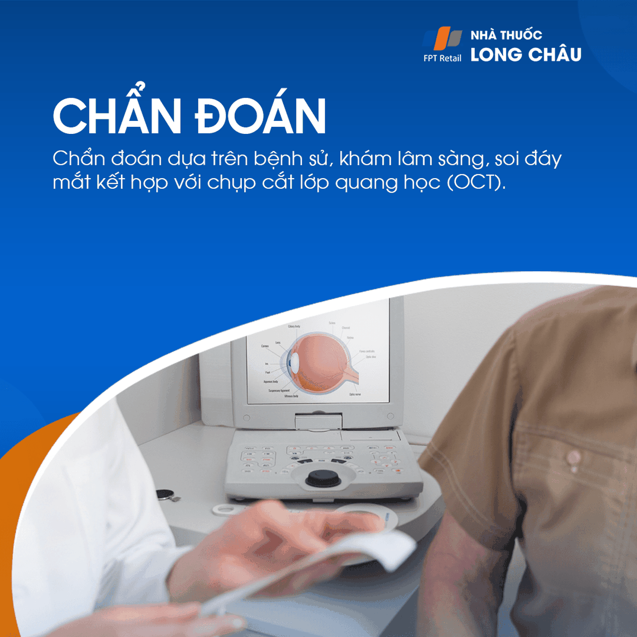 Màng trước võng mạc 5