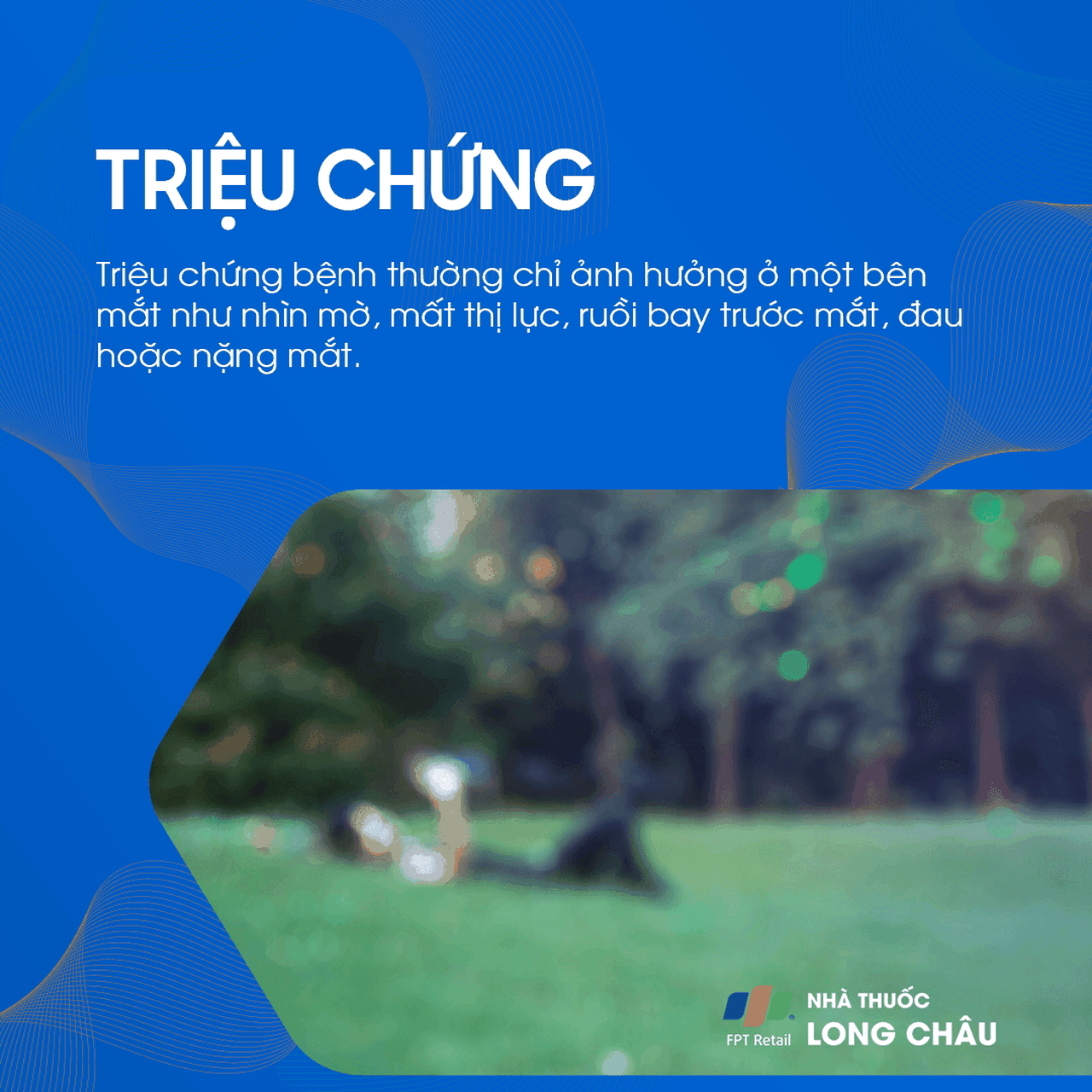 Tắc tĩnh mạch võng mạc 2