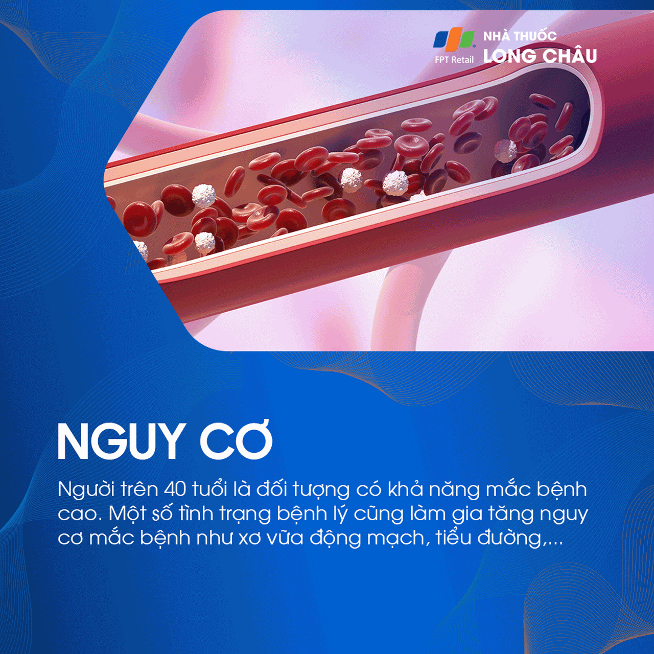 tắc tĩnh mạch võng mạc 4