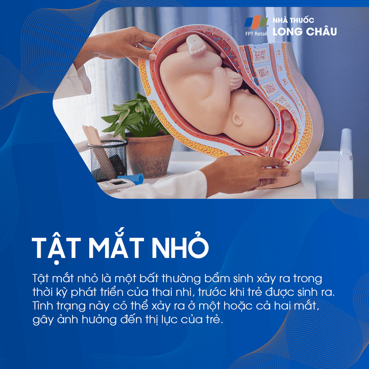Tật mắt nhỏ 1