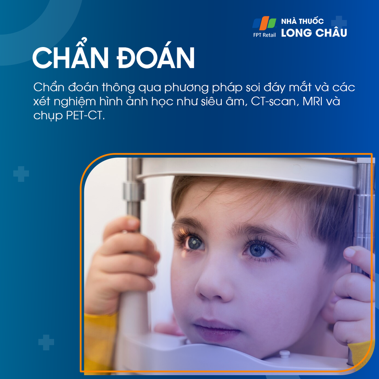 U nguyên bào võng mạc 6