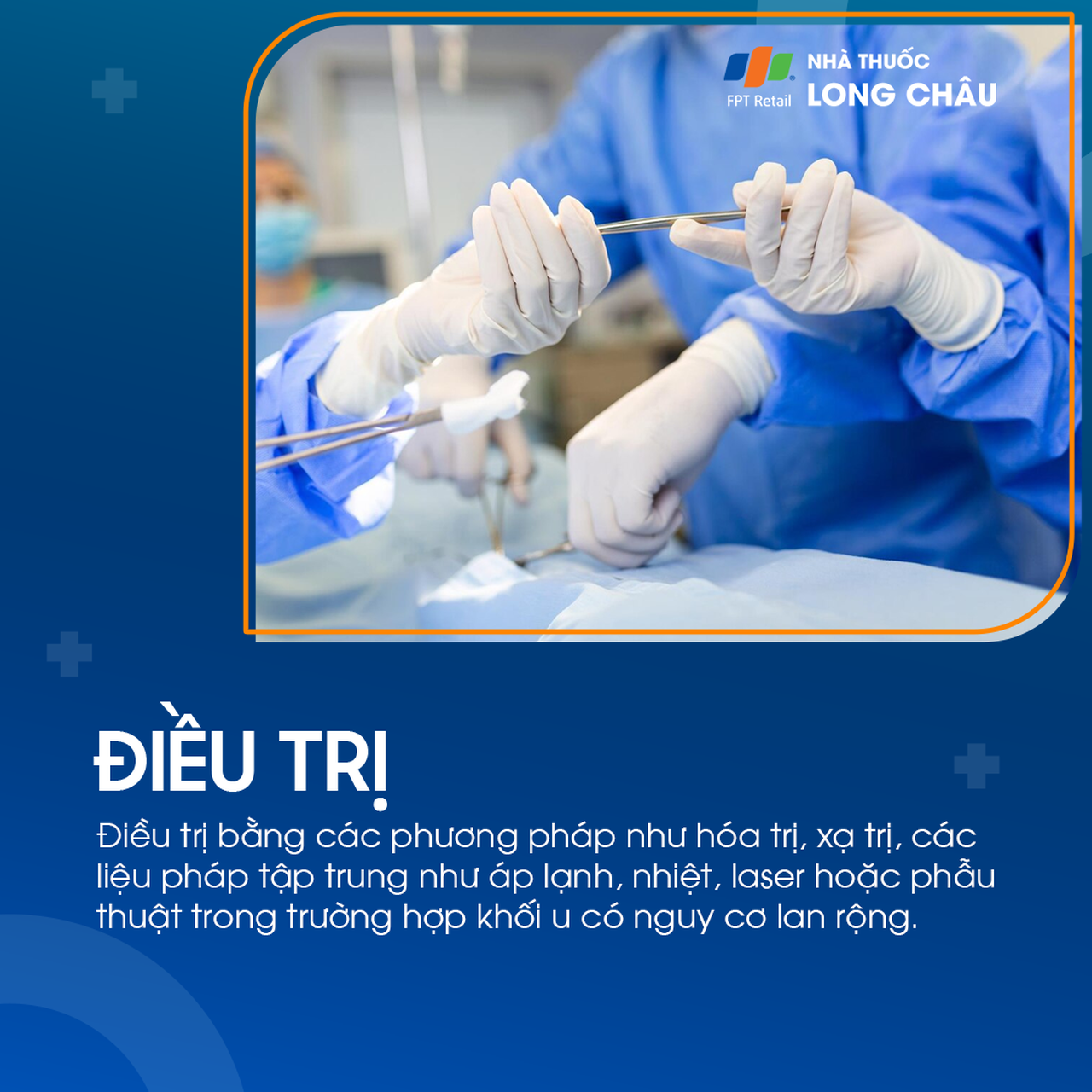 U nguyên bào võng mạc 7