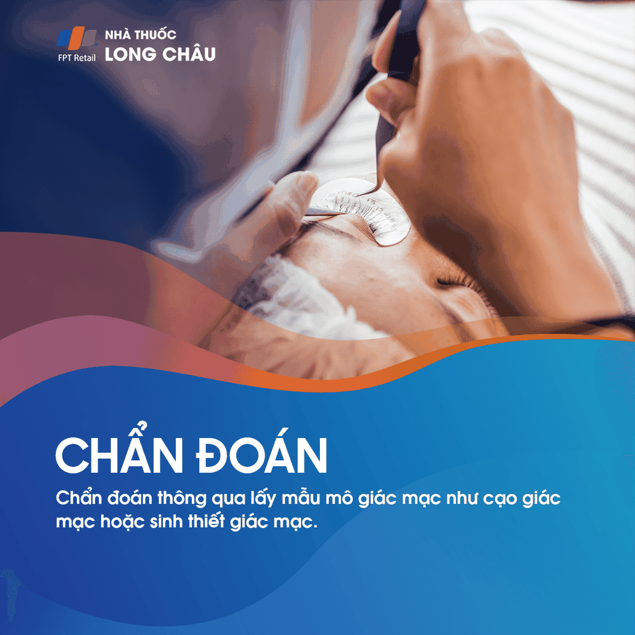 Viêm giác mạc do Acanthamoeba 5