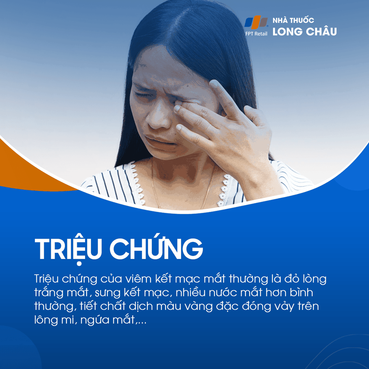 Viêm kết mạc mắt 2