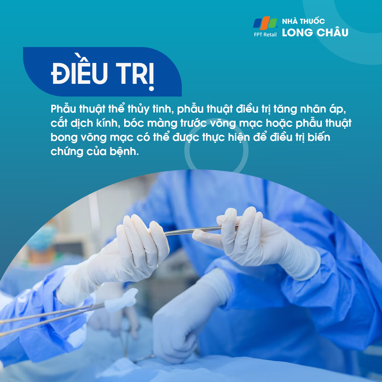 Viêm màng bồ đào 8