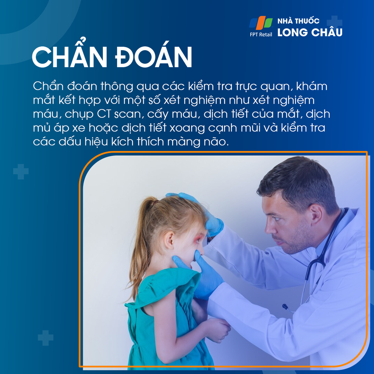 Viêm mô tế bào quanh hốc mắt 5