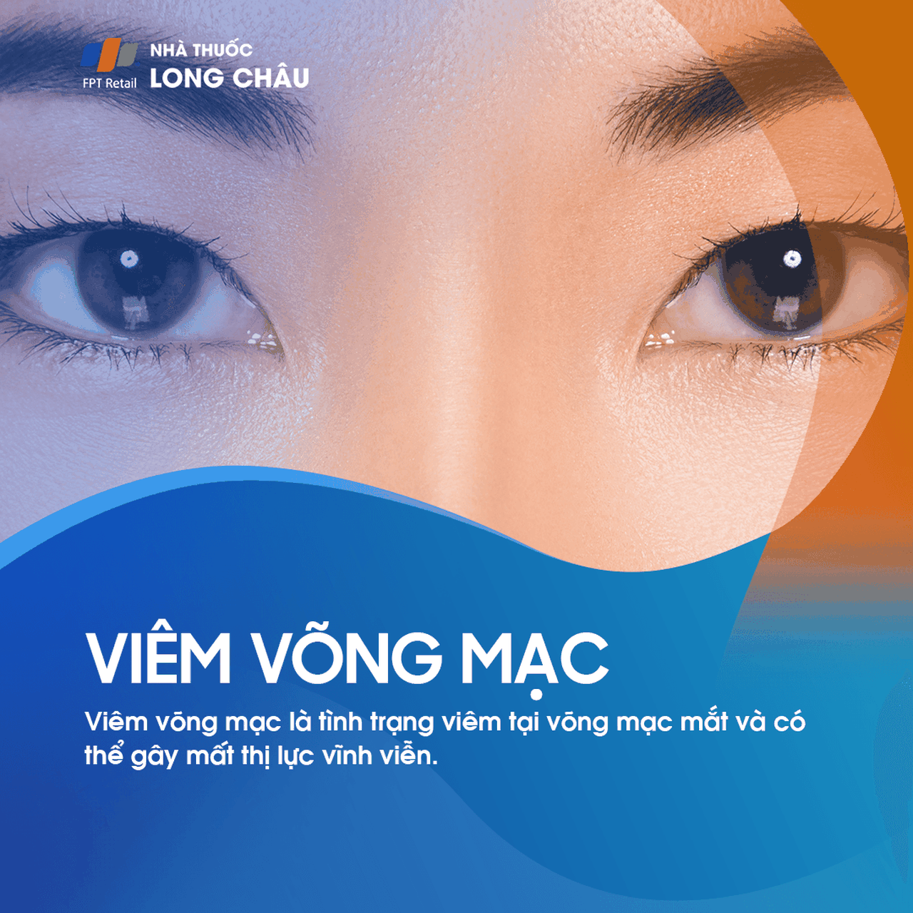 Viêm võng mạc 1