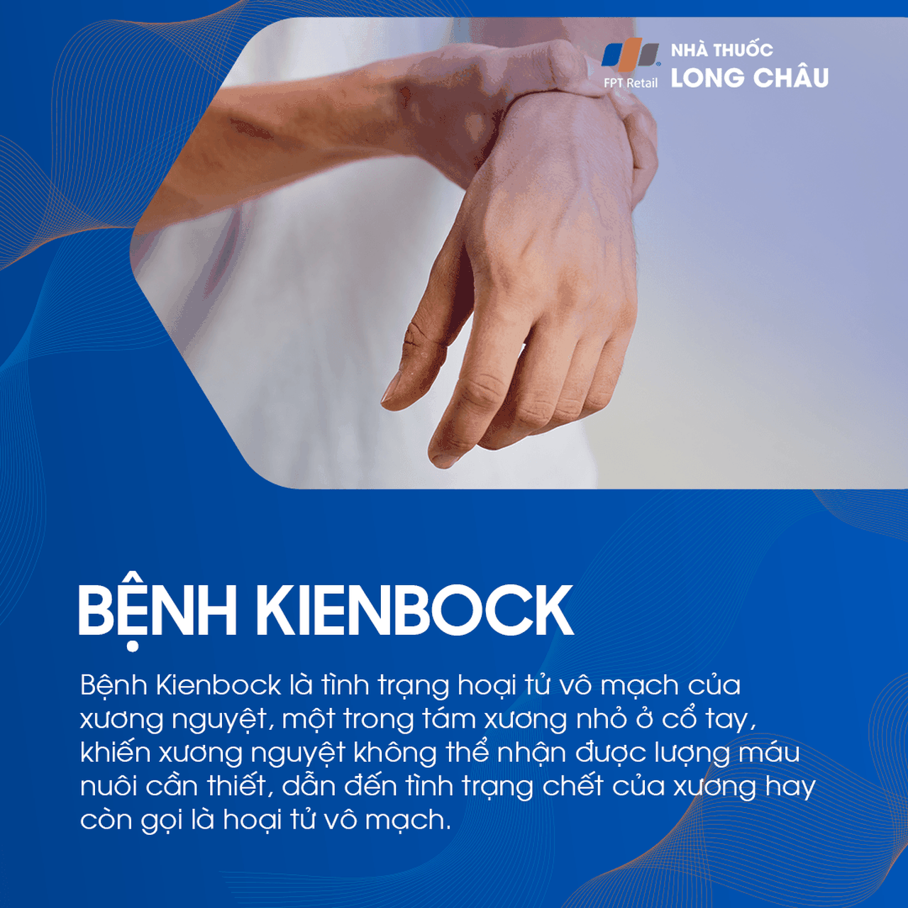 Bệnh kienbock 1