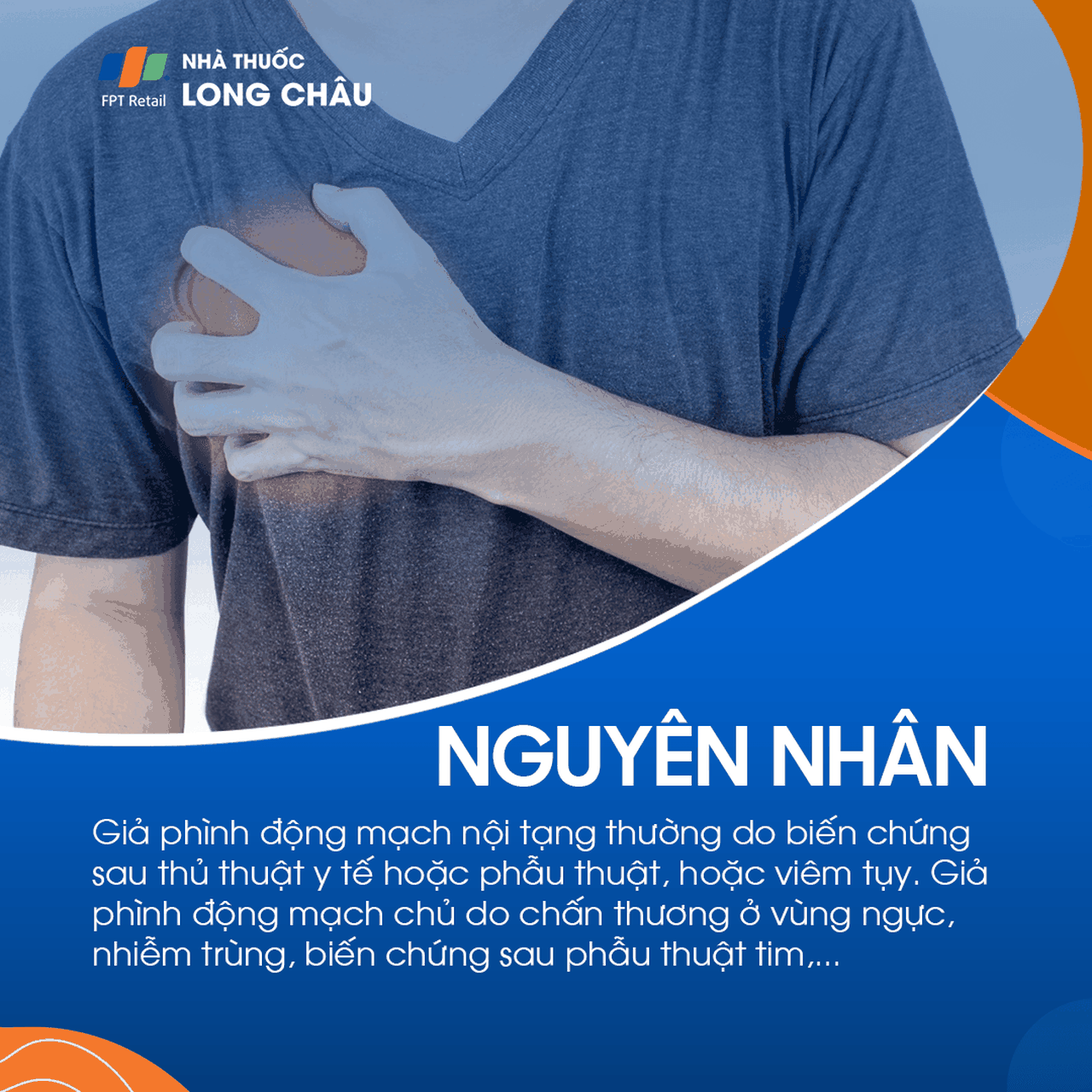 Giả phình mạch 2