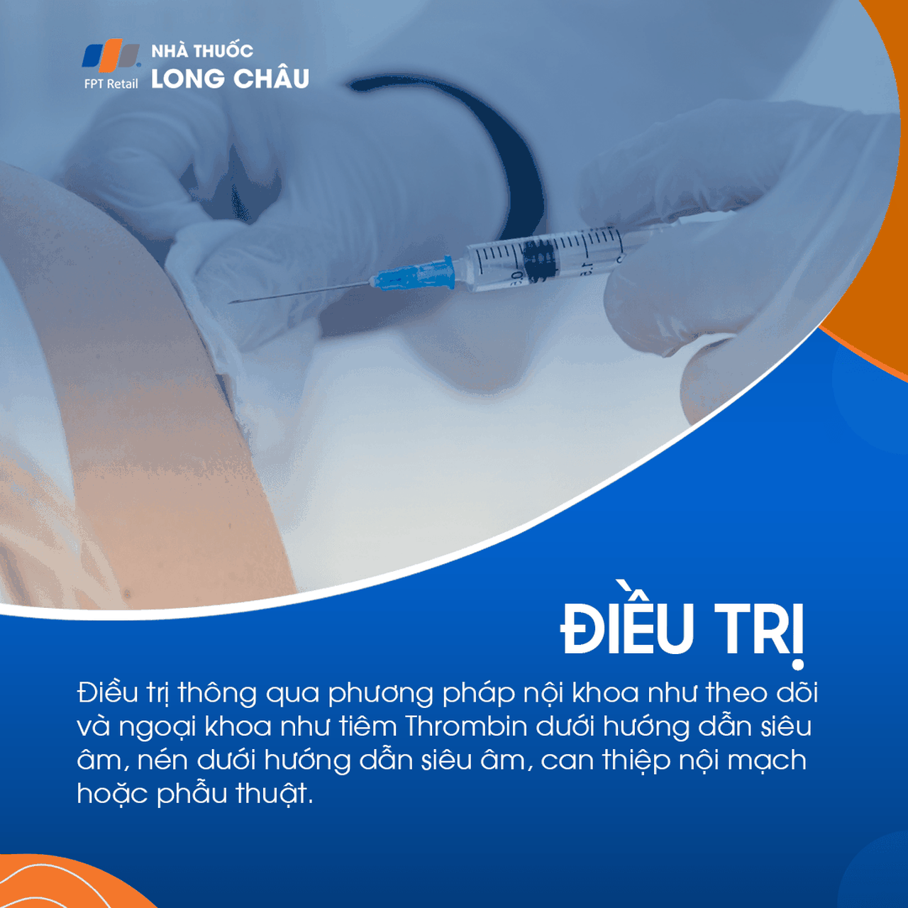 Giả phình mạch 7