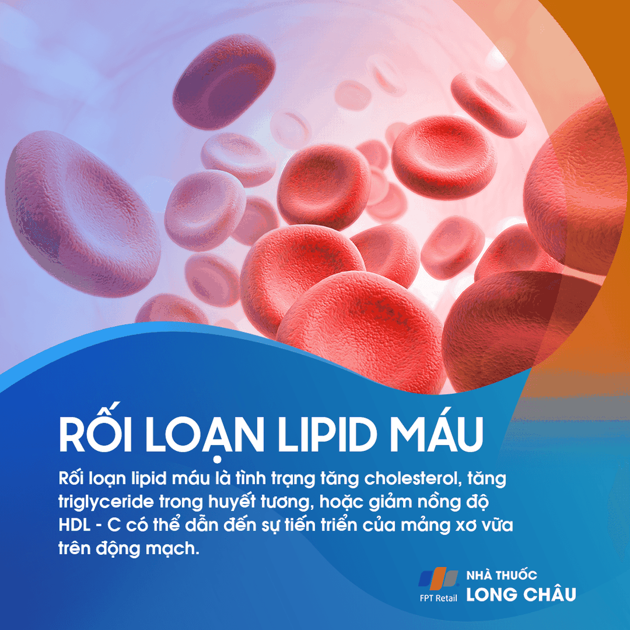 Rối loạn lipid máu