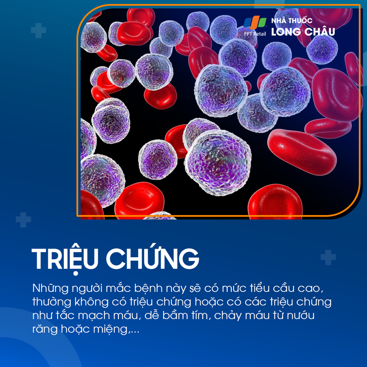 Tăng tiểu cầu tiên phát 2