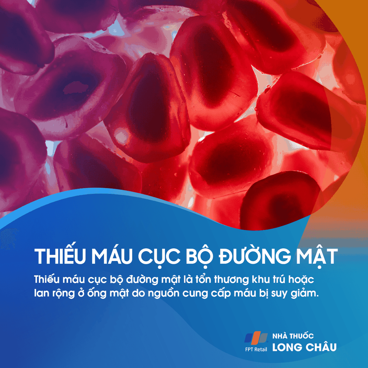 Thiếu máu cục bộ đường mật 1