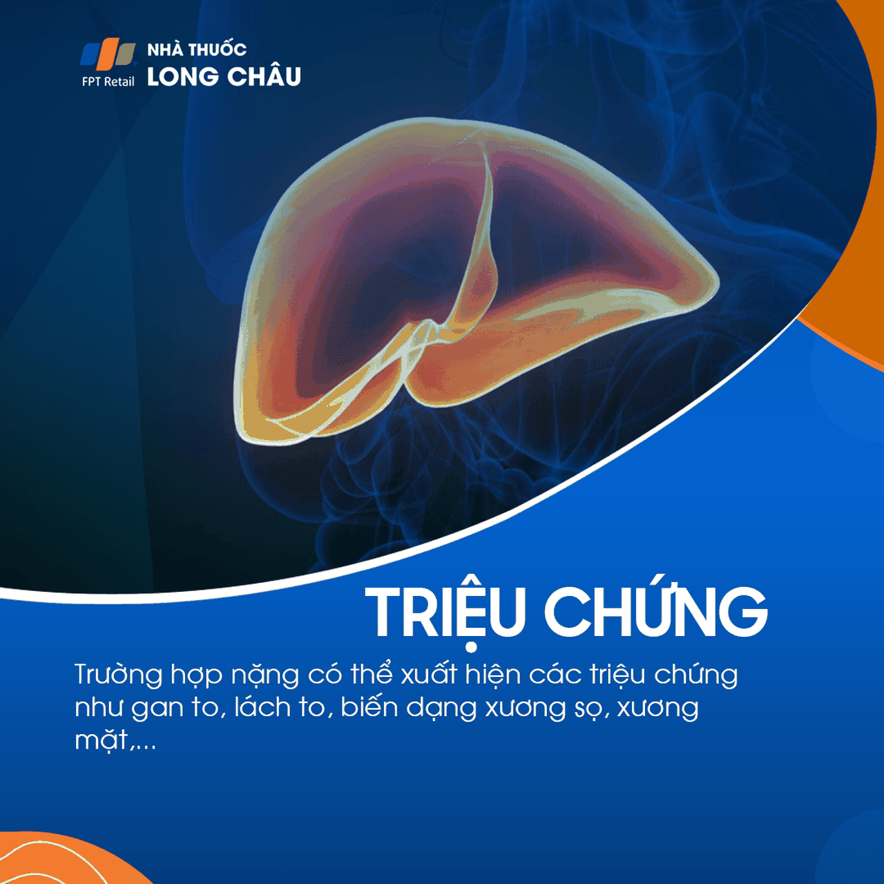 Thiếu máu tán huyết 3