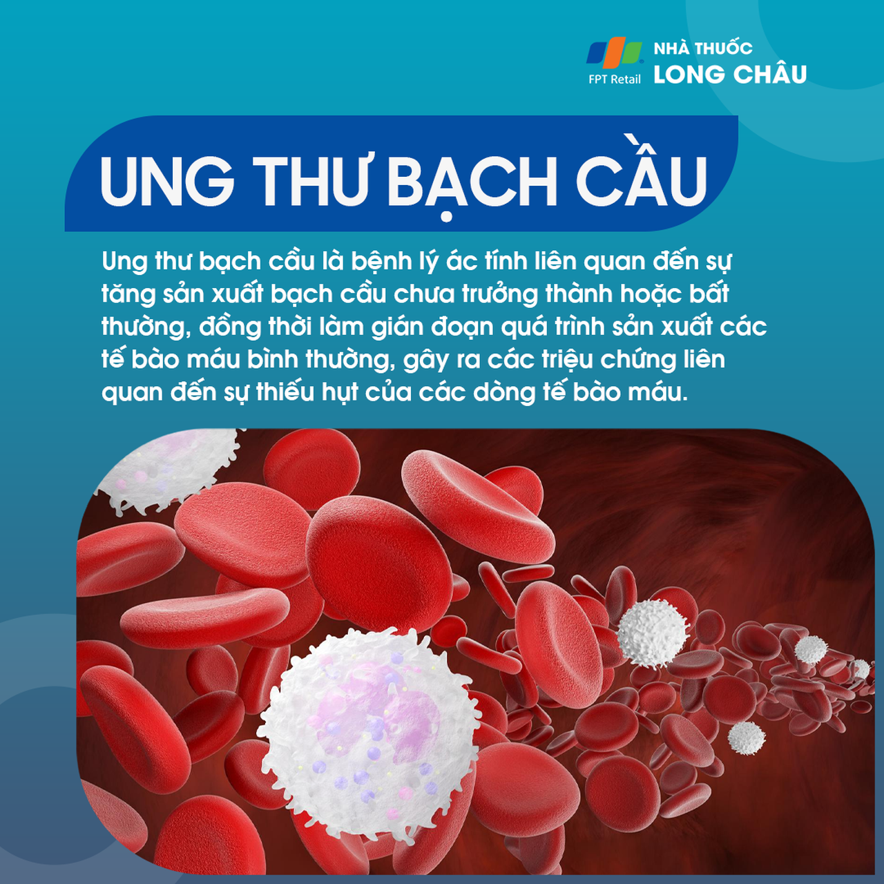 Ung thư bạch cầu 1