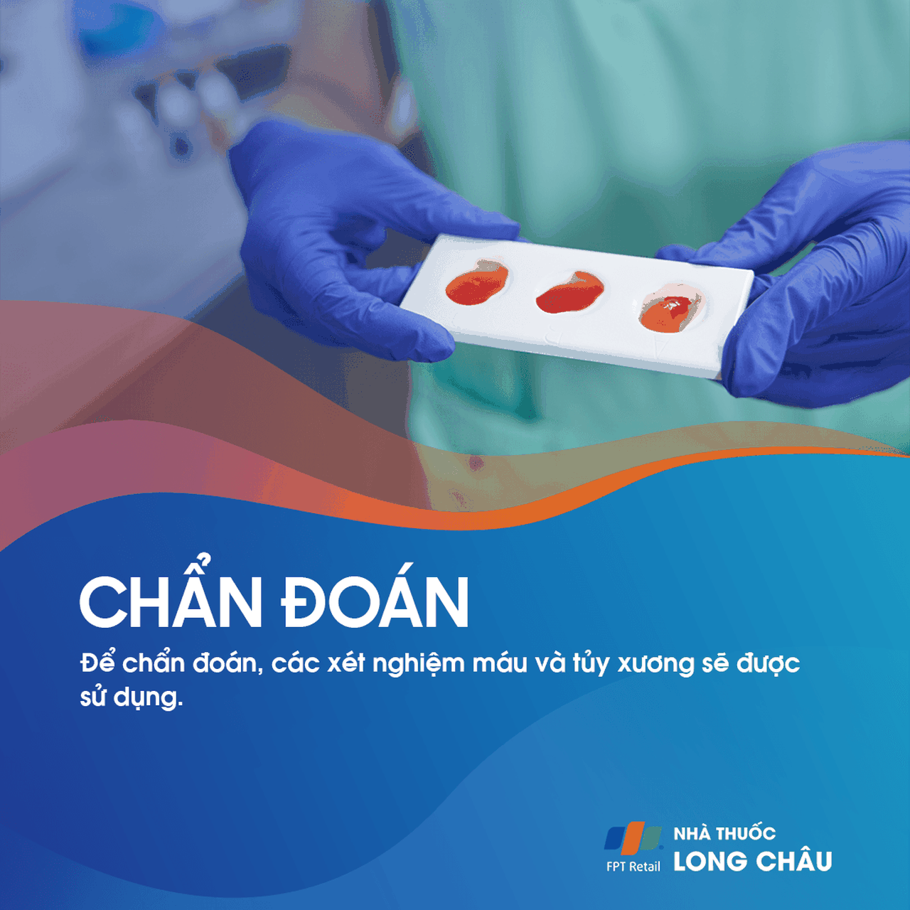 Ung thư máu cấp tính 5