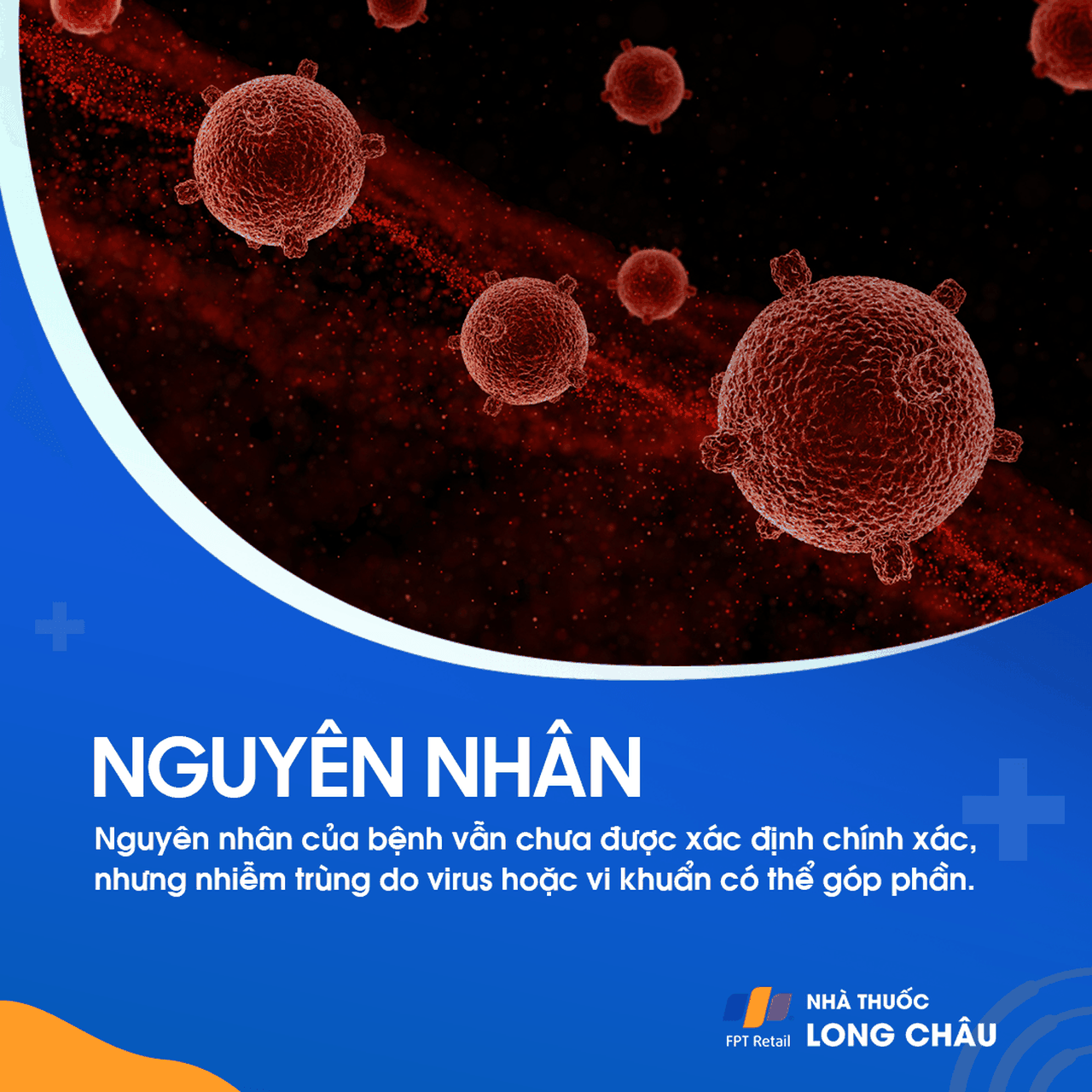 Viêm động mạch thái dương 3