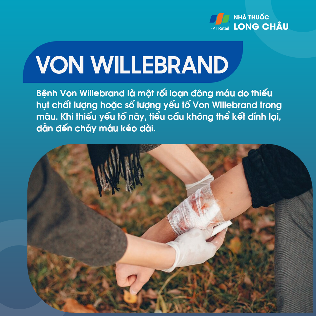 Bệnh Von Willebrand 1