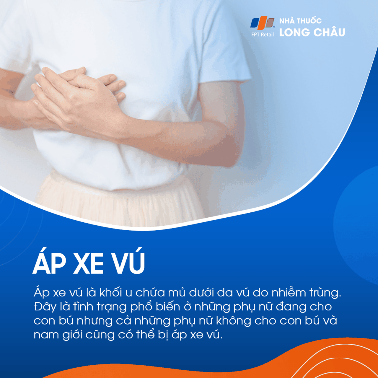 Áp xe vú là khối u mủ dưới da vú do nhiễm trùng, phổ biến ở phụ nữ cho con bú