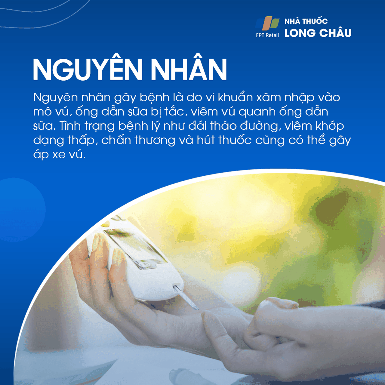 Nguyên nhân áp xe vú do vi khuẩn xâm nhập, tắc ống dẫn sữa, viêm vú hoặc bệnh nền