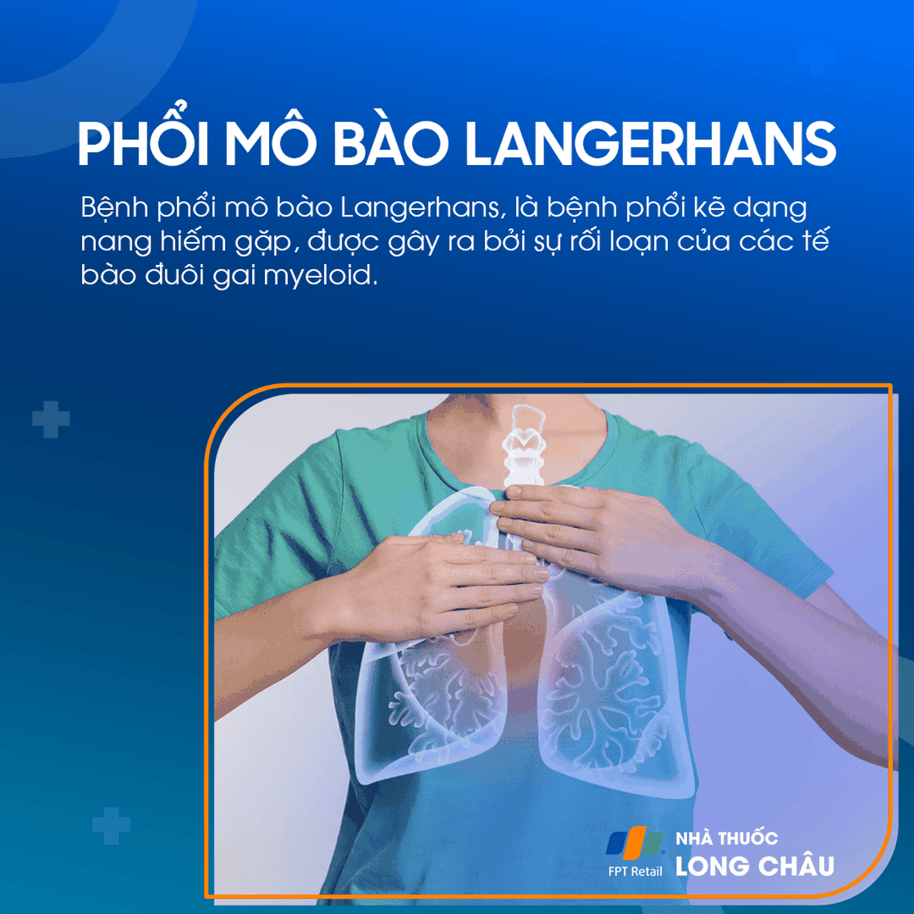 Bệnh phổi mô bào Langerhans 1